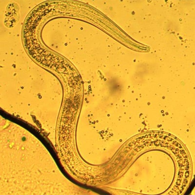 nematode under microscope